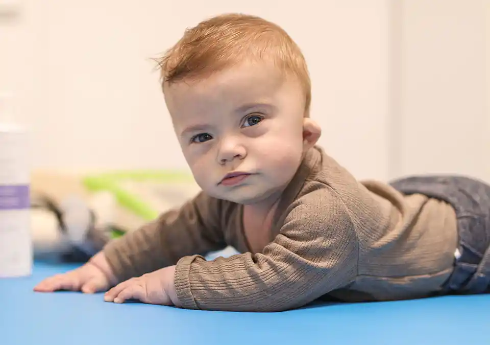 Лицевой паралич